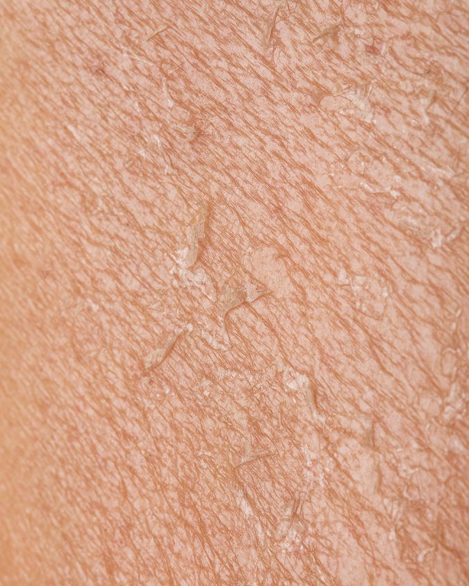 Trockene Haut Pflege